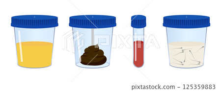 Medical analysis containing urine, feces, blood and sperm samples Medical analysis containing urine, feces, blood and sperm samples 125359883