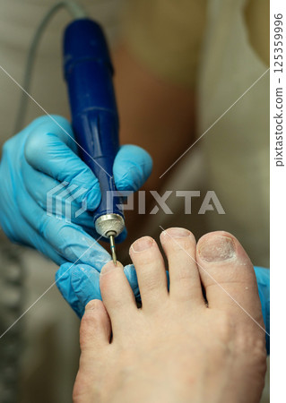 Technician precisely cleans toenails using a slim electric drill bit. 125359996