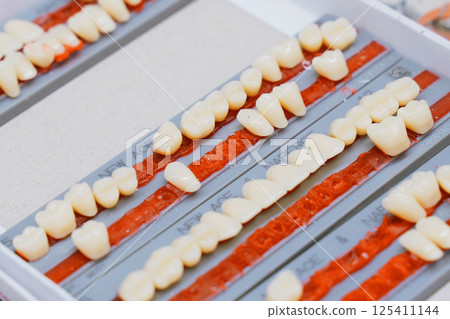 Variety of dentures displayed in dental laboratory for various patient needs 125411144