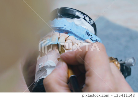 Crafting precision in ceramic dentures for dental restoration and health 125411148