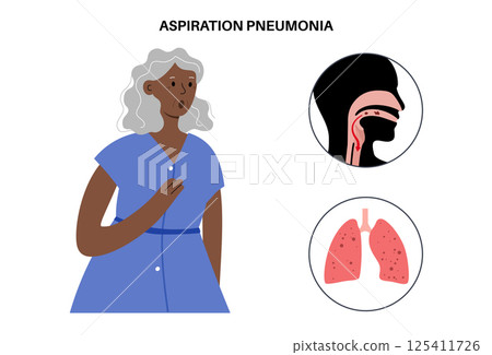 Aspiration pneumonia poster 125411726