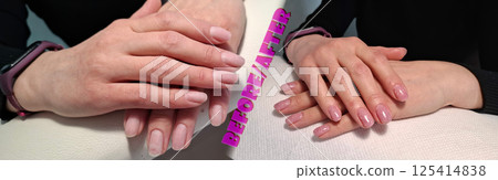 Hands before and after manicure. Favorite female hands with pink varnished nails that harmoniously match the skin color. Hands before and after manicure. Favorite female hands with pink varnished nails that harmoniously match the skin color. 125414838
