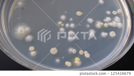 Colonies growing in a petri dish 125416679