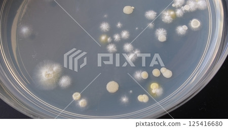 Bacterial colonies 125416680