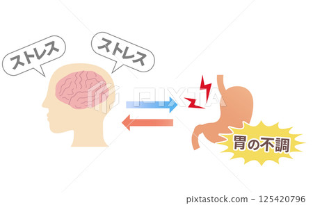 壓力如何導致胃痛、胃腦相關性和功能性消化不良的概念圖。 125420796