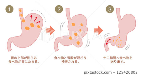 胃消化食物的示意圖 胃消化食物的示意圖 125420802