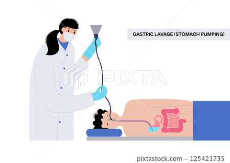 Stomach wash gastric lavage 125421735