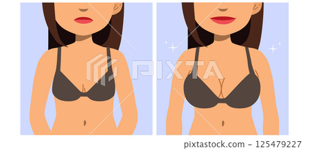 Breast Augmentation Woman Before and After Plastic Surgery Vector Illustration 125479227