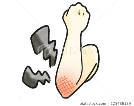 Elbow pain that feels like an electric current running through it (black) 125486129