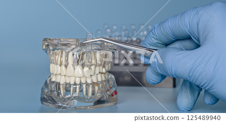 Demonstration of a dental implant with a size scale Demonstration of a dental implant with a size scale 125489940
