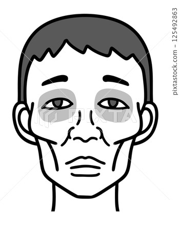 希波克拉底面部特徵，瘦削的男性面孔，黑白 125492863