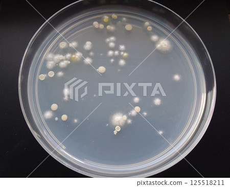 培養皿中生長的菌落 125518211
