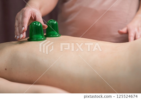 A woman undergoing a massage using vacuum plastic jars. A woman undergoing a massage using vacuum plastic jars. 125524674