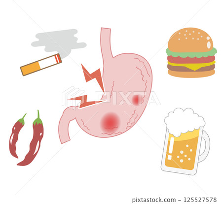 對胃有害的飲食與生活習慣 125527578