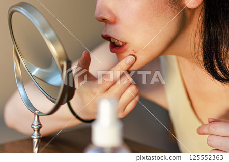 中年婦女擔心痣 125552363