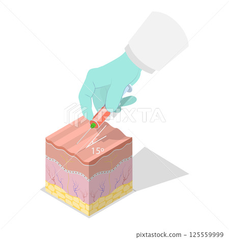 3D Isometric Flat  Illustration of Types Of Injections. Item 4 125559999