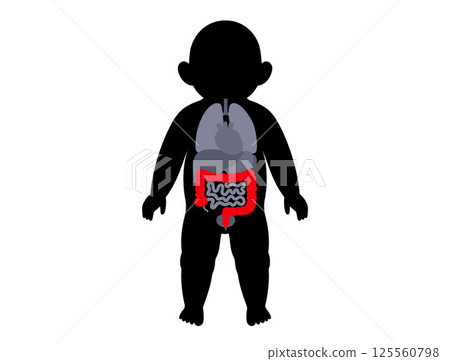 Intestines diseases in a child 125560798