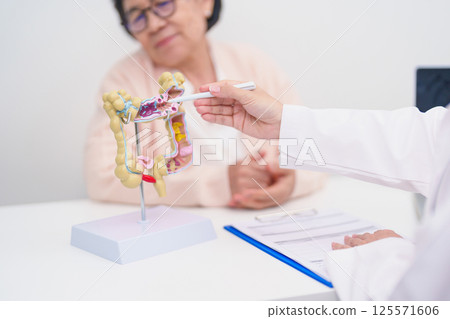 Elderly woman Patient consultation with doctor for Colon disease, Large Intestine, Colorectal cancer, Ulcerative colitis, Diverticulitis, Irritable bowel syndrome, Digestive system and Healthcare 125571606