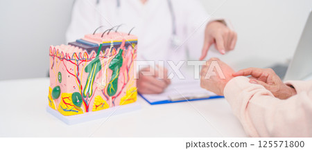 woman Patient consultation Dermatologist with anatomy of skin and hair. Skin disease and Hair loss, Systemic Lupus Erythematosus or SLE, world lupus day, May Melanoma and Skin Cancer Awareness month 125571800