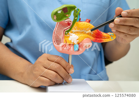 Pancreatitis, pancreatic cancer, Asian doctor with pancreas, gallbladder and bile duct human anatomy model at hospital. 125574080