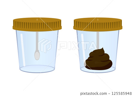 Stool sample in medical container and empty container with spoon Stool sample in medical container and empty container with spoon 125585948
