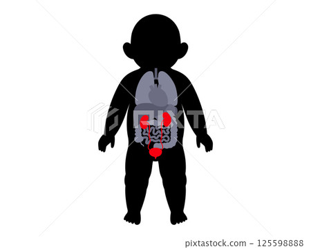 Kidney diseases in a child 125598888