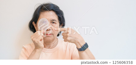 Elderly Woman with eye protective shield after eye surgery. Eye disease, Cataract,  Glaucoma, Age Related Macular Degeneration, Diabetic Retinopathy, Vitreous, Lasik, World Glaucoma day and health 125606358