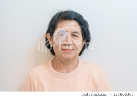 Elderly Woman with eye protective shield after eye surgery. Eye disease, Cataract,  Glaucoma, Age Related Macular Degeneration, Diabetic Retinopathy, Vitreous, Lasik, World Glaucoma day and health 125606365