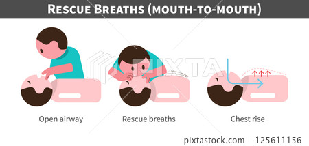CPR . Cardiopulmonary resuscitation . Procedure of rescue breaths and mouth ot mouth . Flat design cartoon characters . Isolate white background . Vector . 125611156