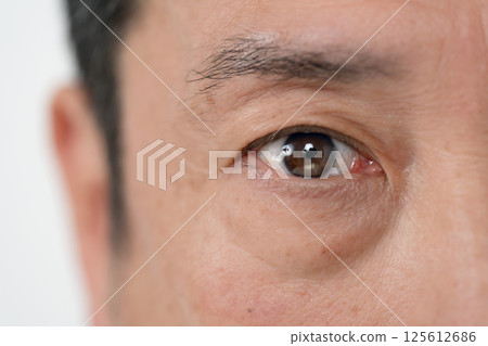 男性眼睛 眼睛脆弱 125612686