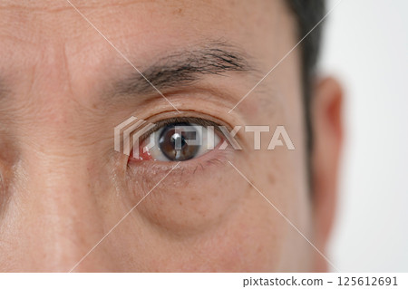 男性眼睛 眼睛脆弱 125612691