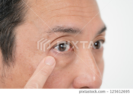 男性眼睛 眼睛脆弱 125612695