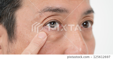 Male Eyes Eye Frailty Male Eyes Eye Frailty 125612697
