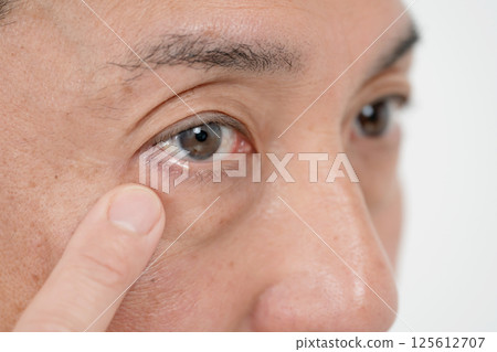 Male Eyes Eye Frailty 125612707