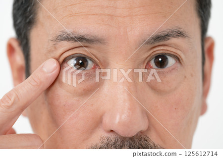 Male Eyes Eye Frailty 125612714