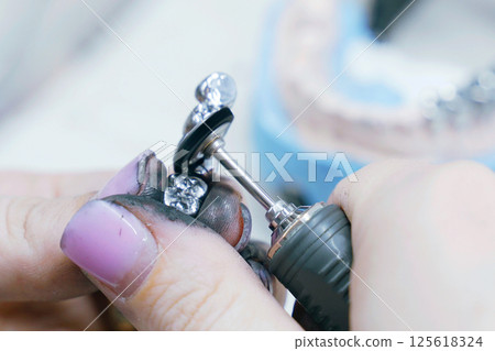 Crafting precision metal dentures with skilled hands in a modern dental lab 125618324