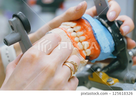 Crafting custom dentures with precision for perfect dental fit Crafting custom dentures with precision for perfect dental fit 125618326