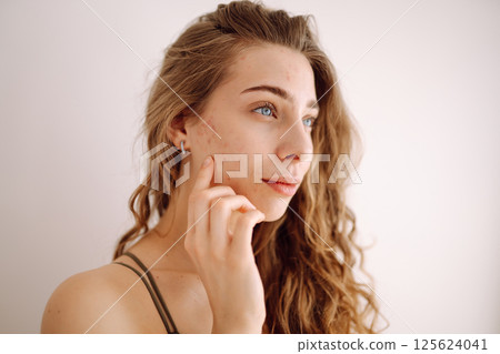 Portrait of a beautiful woman with inflammations on the skin of her face. Medicine and cosmetology. 125624041