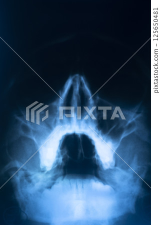 Xray scan skull nose 125650481