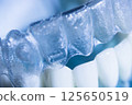 Invisible bracket aligners 125650519