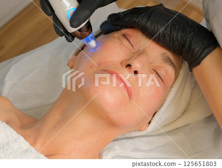 Close-up portrait of a beautiful aged woman during microneedling with dermapen from a beautician. Close-up portrait of a beautiful aged woman during microneedling with dermapen from a beautician. 125651803