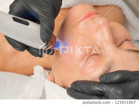 Close-up portrait of a beautiful aged woman during microneedling with dermapen from a beautician. 125651807