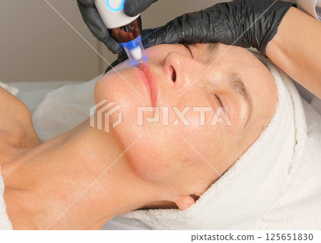 Close-up portrait of a beautiful aged woman during microneedling with dermapen from a beautician. 125651830