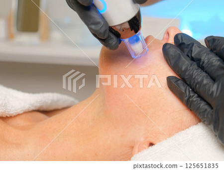 Close-up portrait of a beautiful aged woman during microneedling with dermapen from a beautician. Close-up portrait of a beautiful aged woman during microneedling with dermapen from a beautician. 125651835