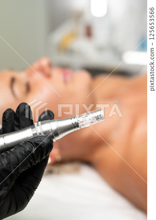 Microneedle RF lifting procedure. A cosmetologist performs a facial rejuvenation procedure on a woman. Hardware cosmetology. Microneedle RF lifting procedure. A cosmetologist performs a facial rejuvenation procedure on a woman. Hardware cosmetology. 125653566