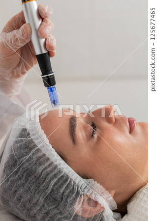 Cosmetologist performs dermapen microneedling on forehead skin of young woman in beauty clinic 125677465