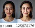 皮膚護理效果 - 年輕女性皮膚前後對比 125678176