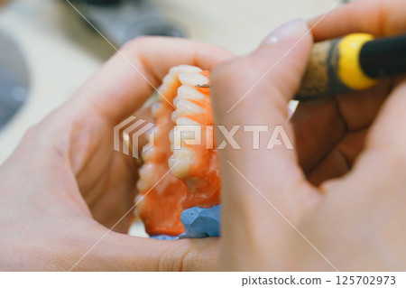 Crafting custom dentures through precision molding and detailing techniques 125702973