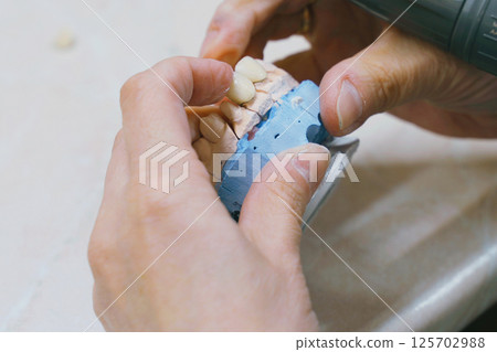 Crafting perfect dentures with precision in dental laboratory setting Crafting perfect dentures with precision in dental laboratory setting 125702988