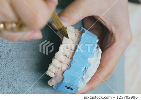 Crafting intricate ceramic dentures with precision in a dental workshop Crafting intricate ceramic dentures with precision in a dental workshop 125702990